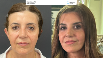 be_af_macsfacelift_1_74399005