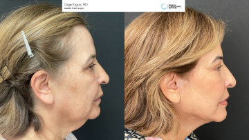 be_af_macsfacelift_67627899